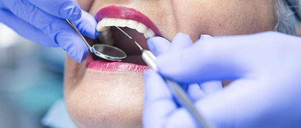 Best Emergency Root Canal Treatment in Beltsville, MD